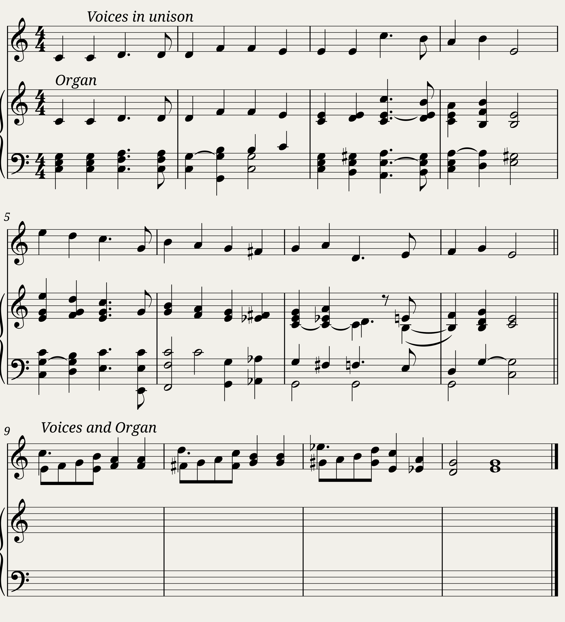 ALLELUIA (Lowe) - Albert Lowe