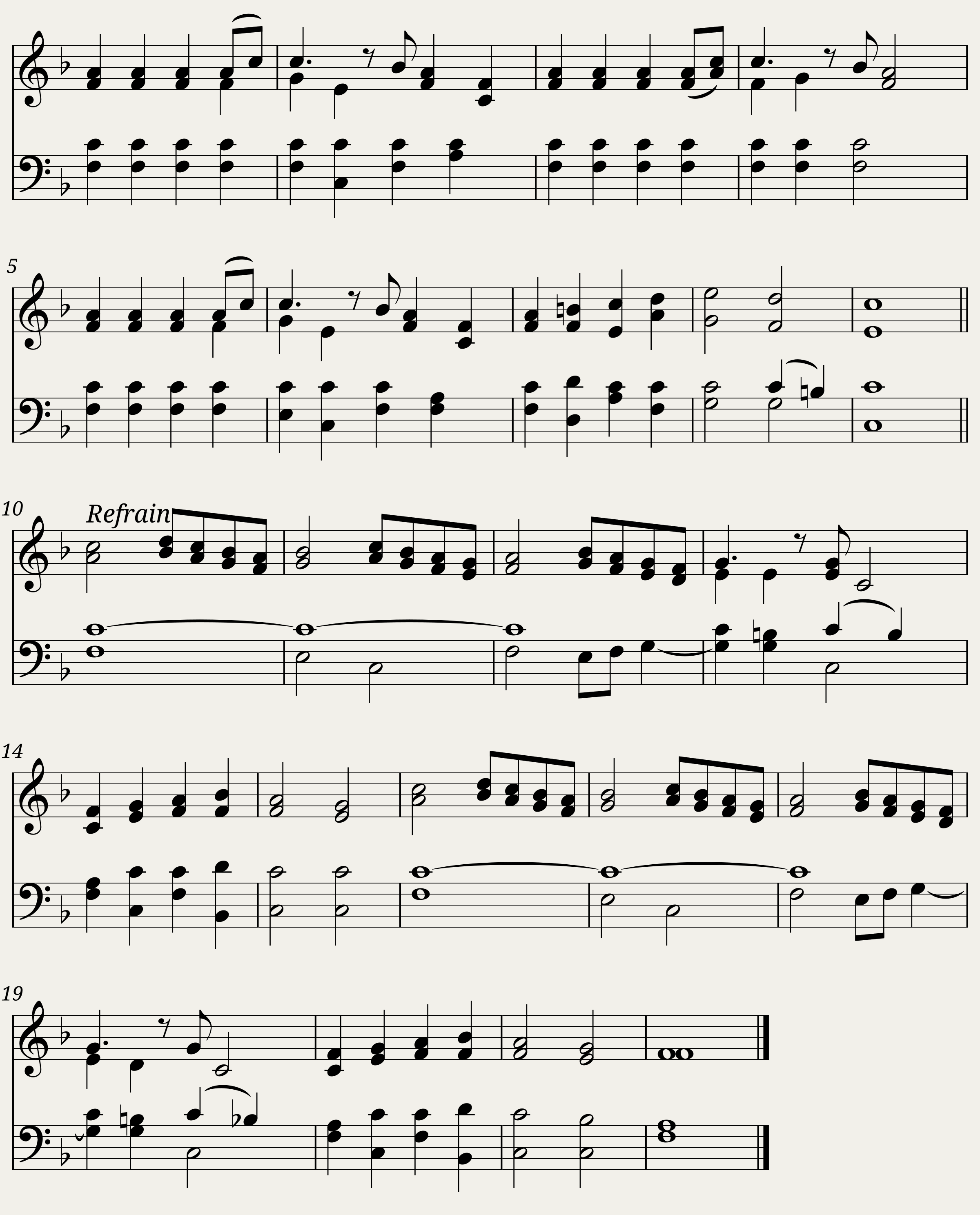 Hearken all! what holy singing - Gloria French carol. A slightly different arrangement is used by Angels We Have Heard on High.