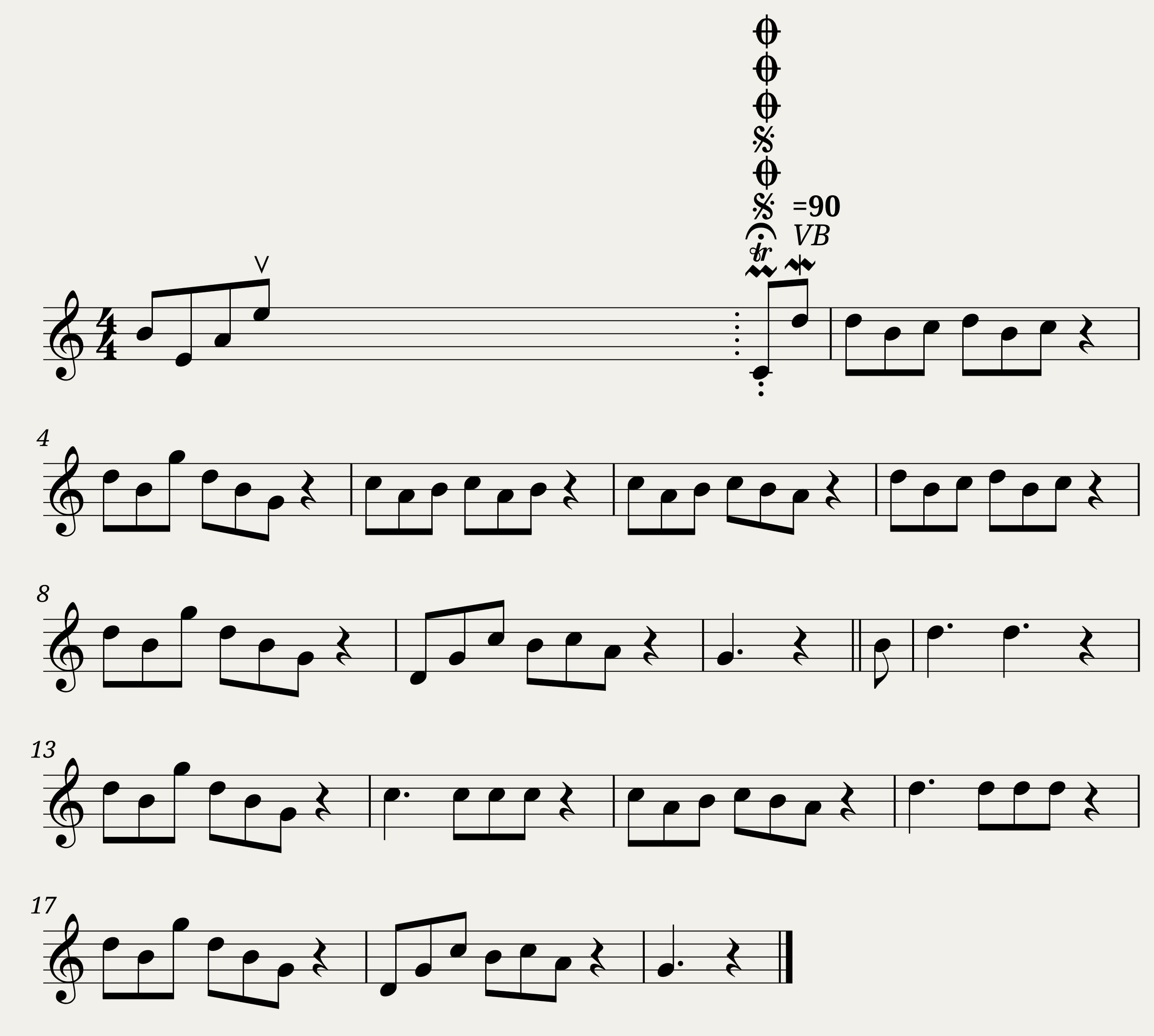 Oh Dear! What Can The Matter Be? (song) 0620