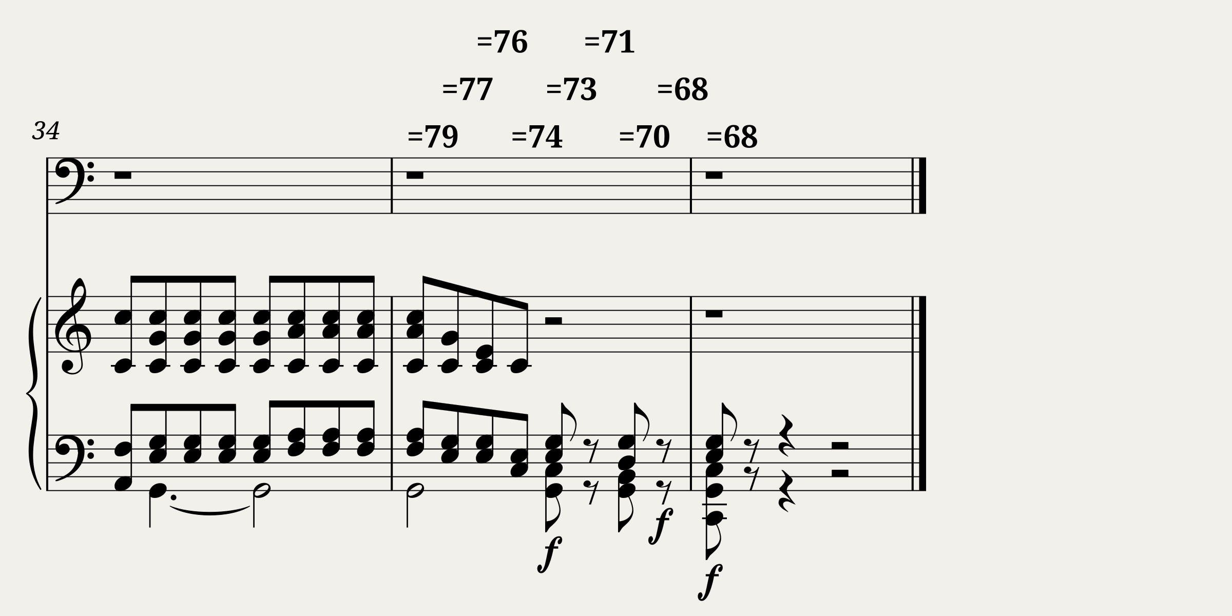 Ich grolle nicht - Robert Schumann — 3/3