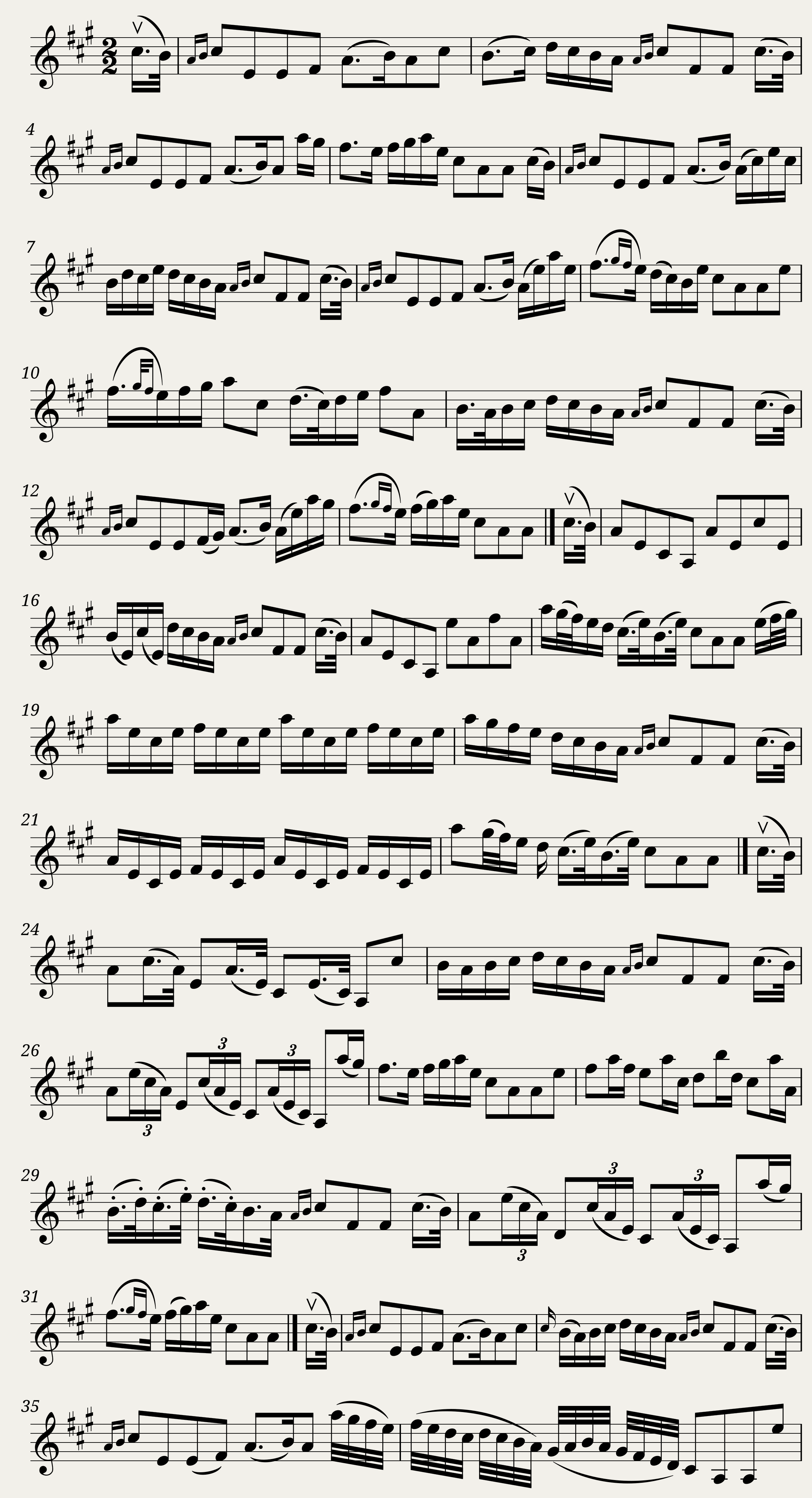 MY AIN KIND DEARIE -- With Variations — 1/3